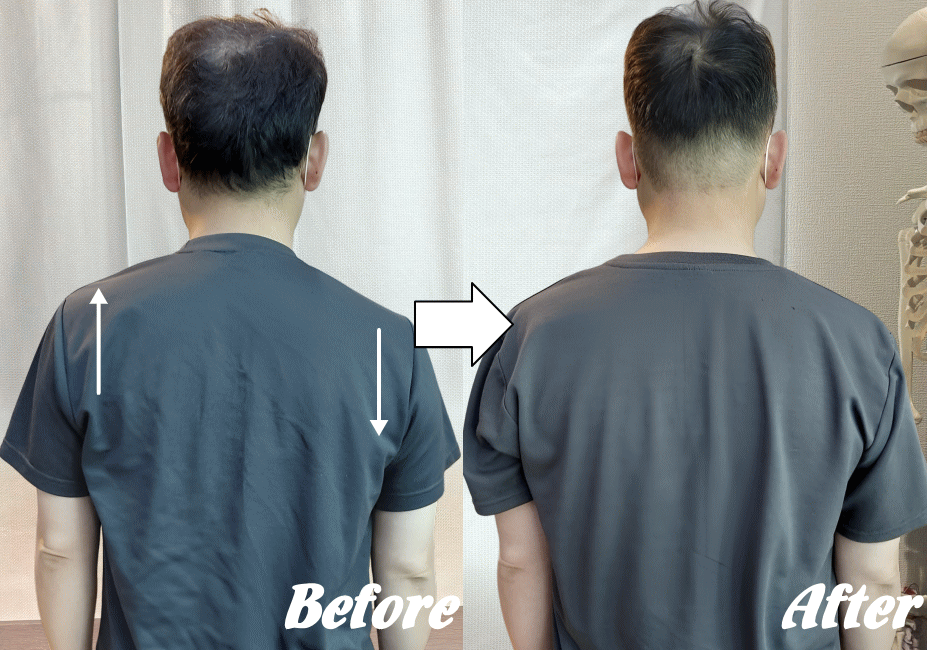 施術前と施術後68