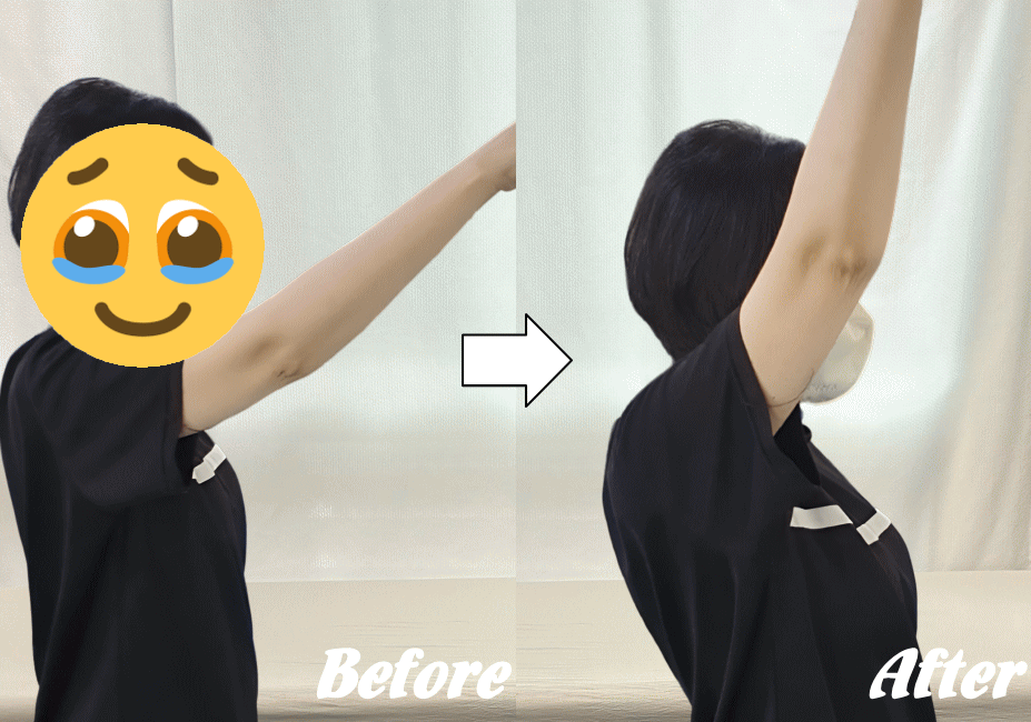 施術前と施術後69