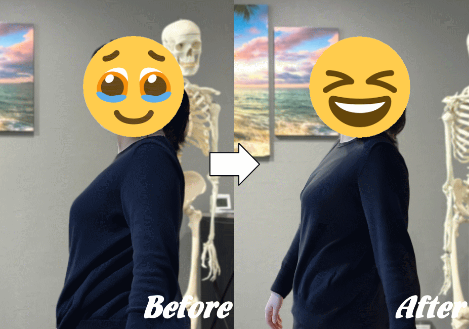 施術前と施術後70