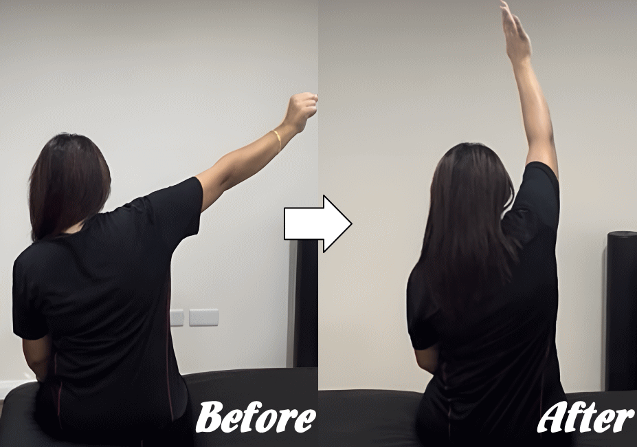 施術前と施術後71