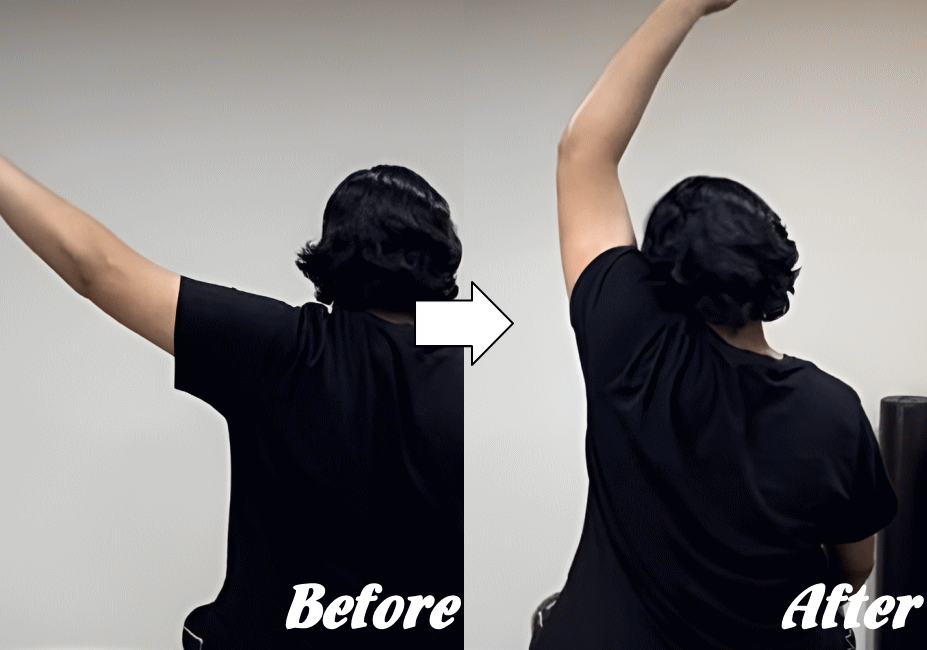 施術前と施術後72