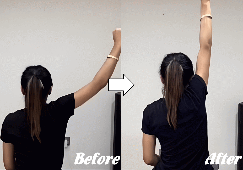 施術前と施術後73