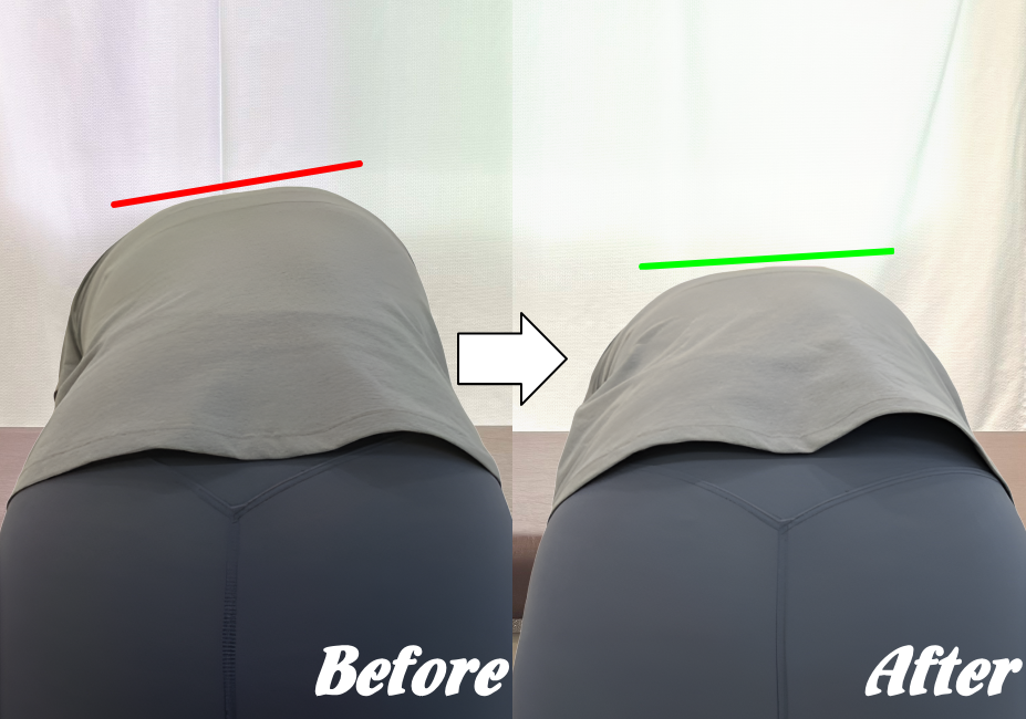 施術前と施術後74