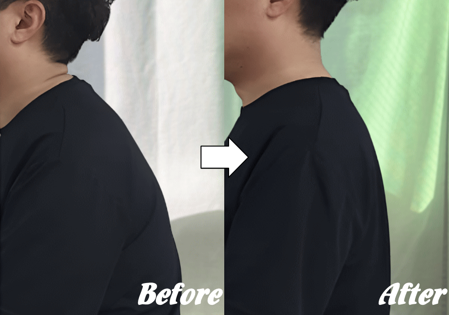 施術前と施術後75