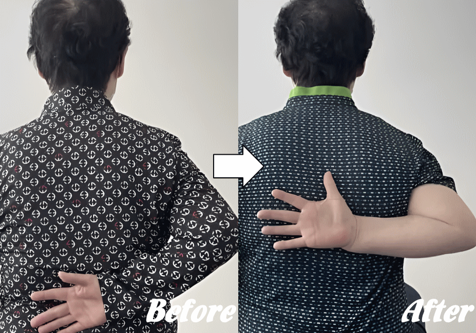 施術前と施術後77