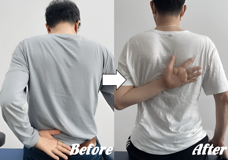 施術前と施術後78