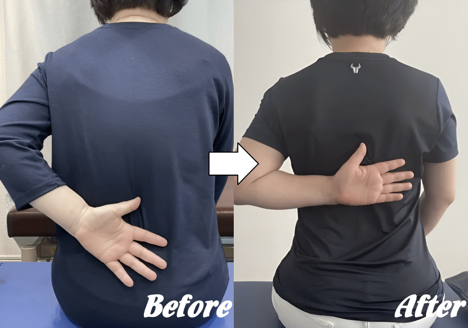 施術前と施術後80