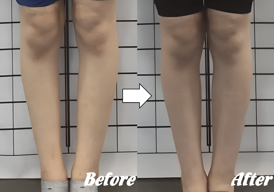 施術前と施術後97