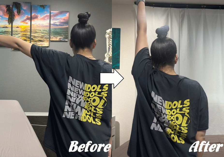 施術前と施術後98