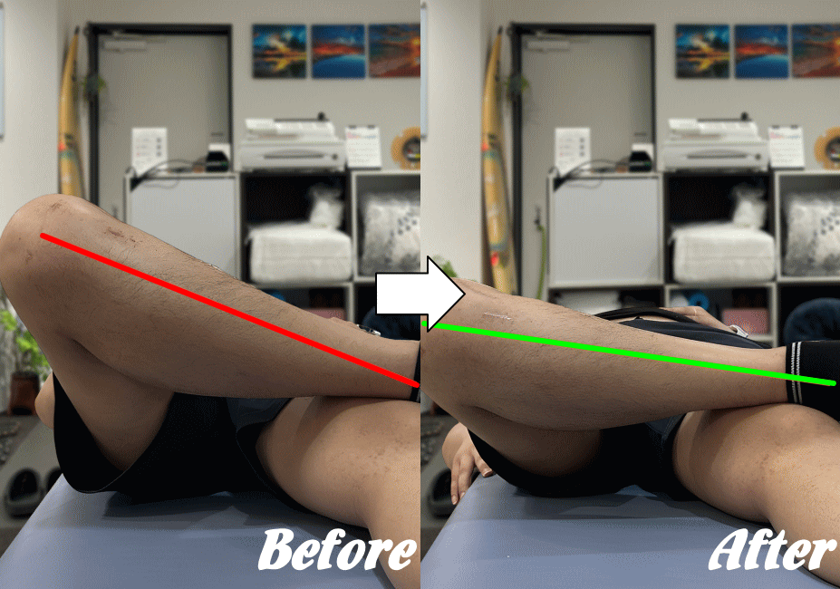 施術前と施術後99