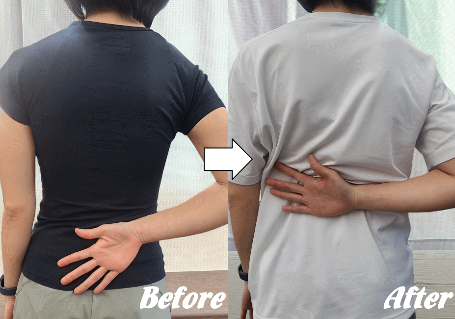 施術前と施術後100