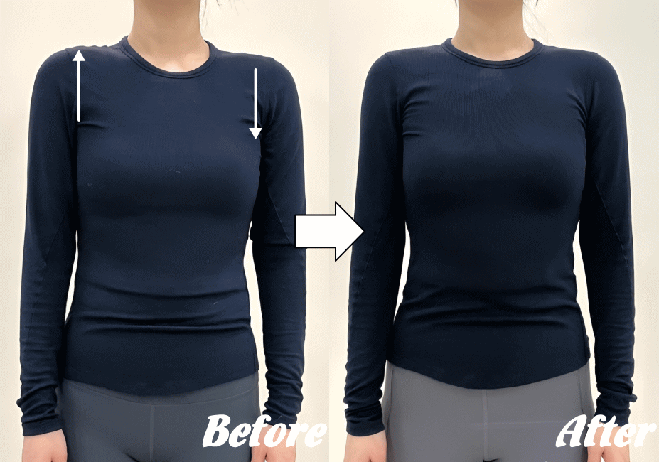 施術前と施術後101