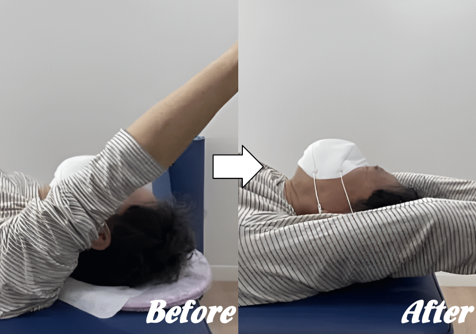 施術前と施術後102