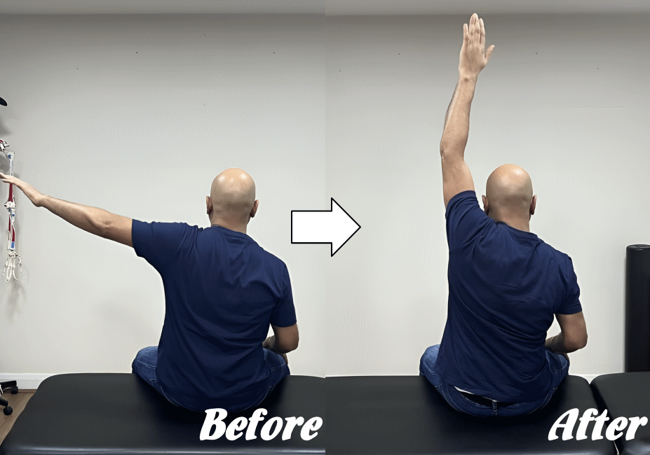 施術前と施術後103