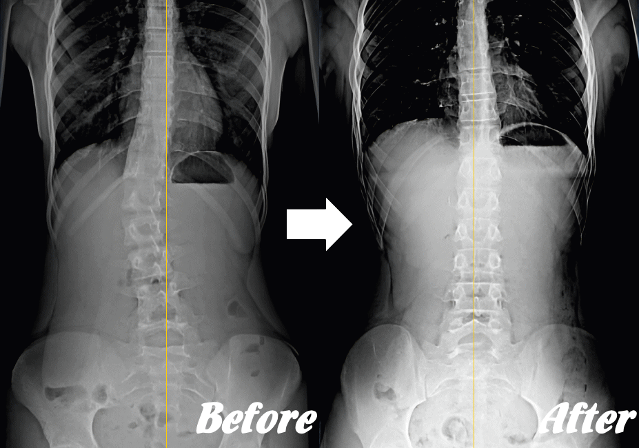 画像検査結果08