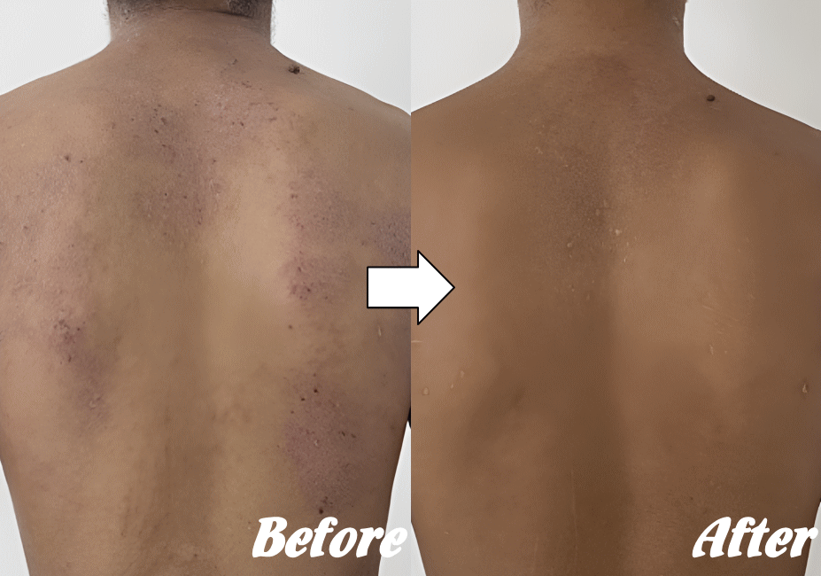 施術前と施術後A