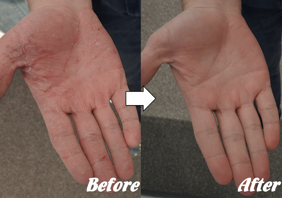 施術前と施術後B