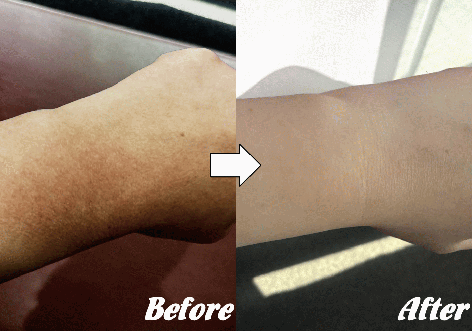 施術前と施術後C