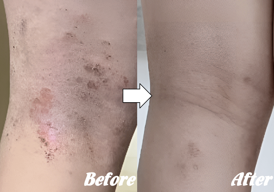 施術前と施術後D