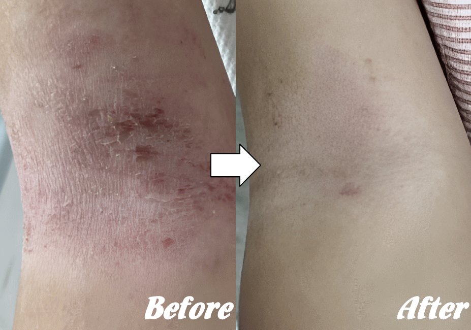 施術前と施術後E