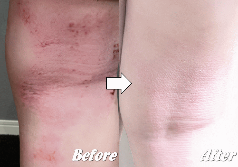 施術前と施術後G