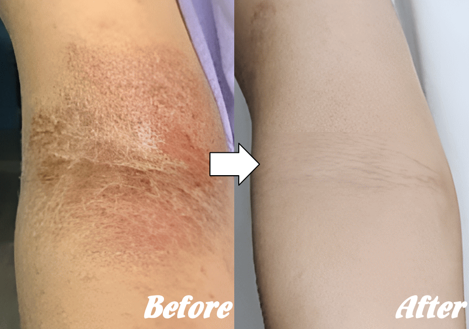 施術前と施術後I