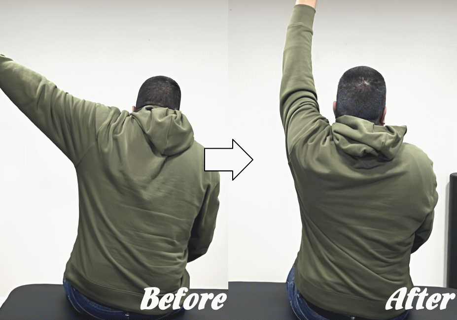 施術前と施術後91