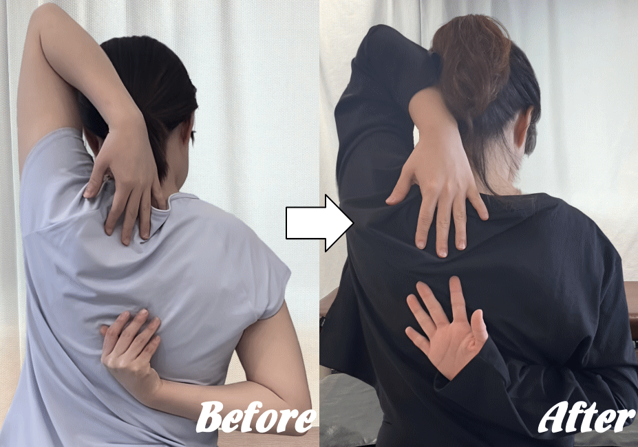 施術前と施術後92