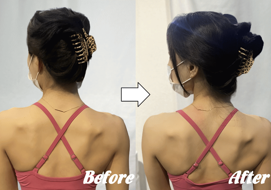 施術前と施術後93