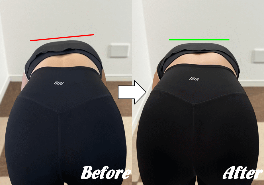 施術前と施術後94