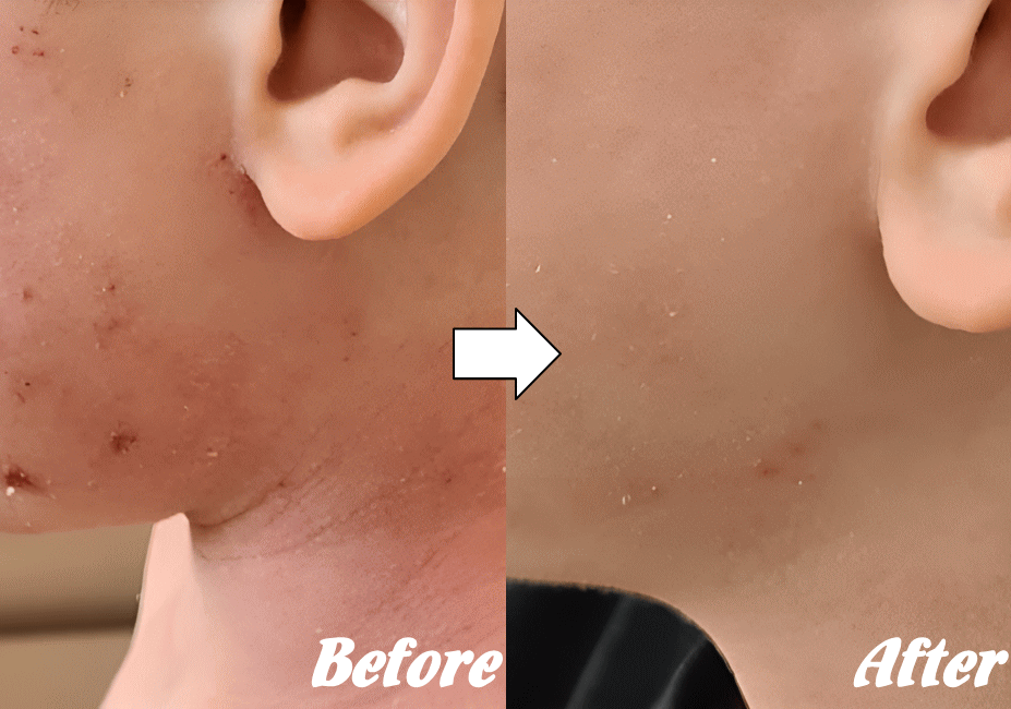 施術前と施術後N