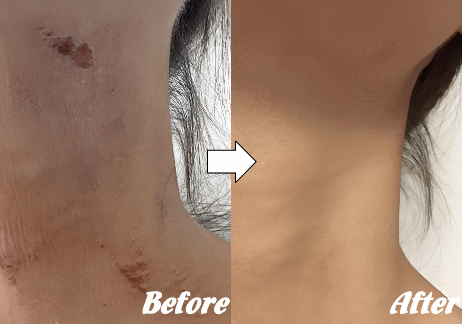 施術前と施術後O