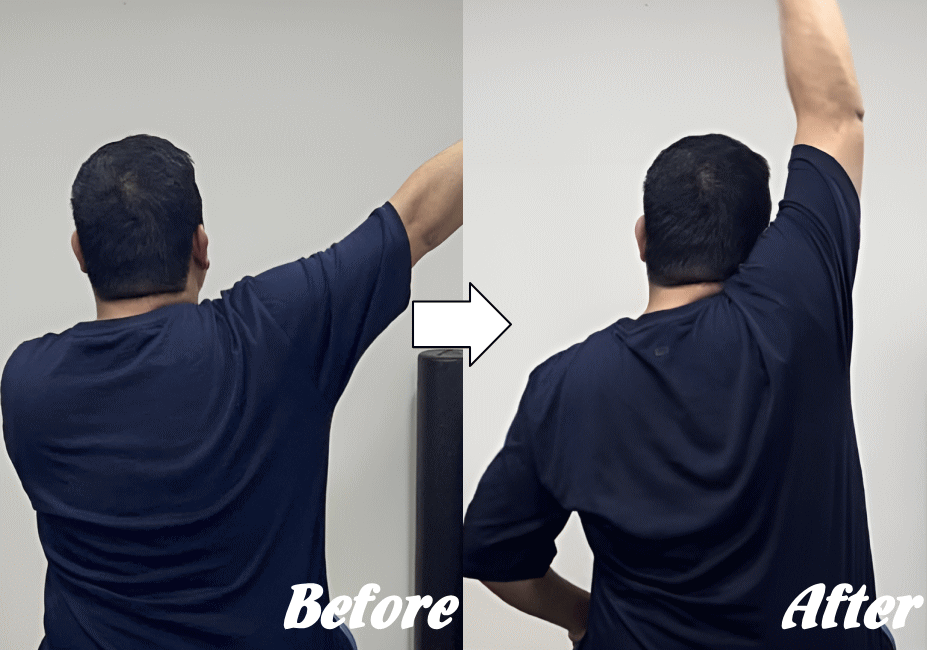 施術前と施術後81