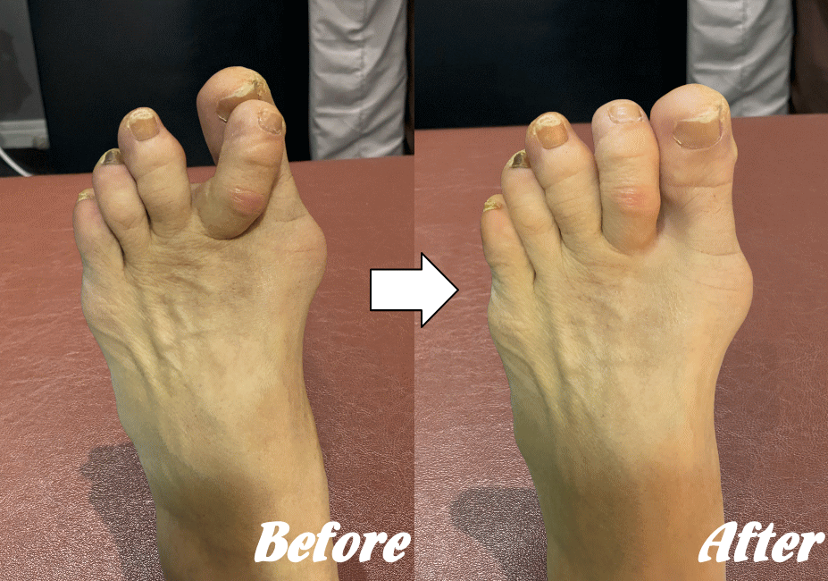 施術前と施術後82