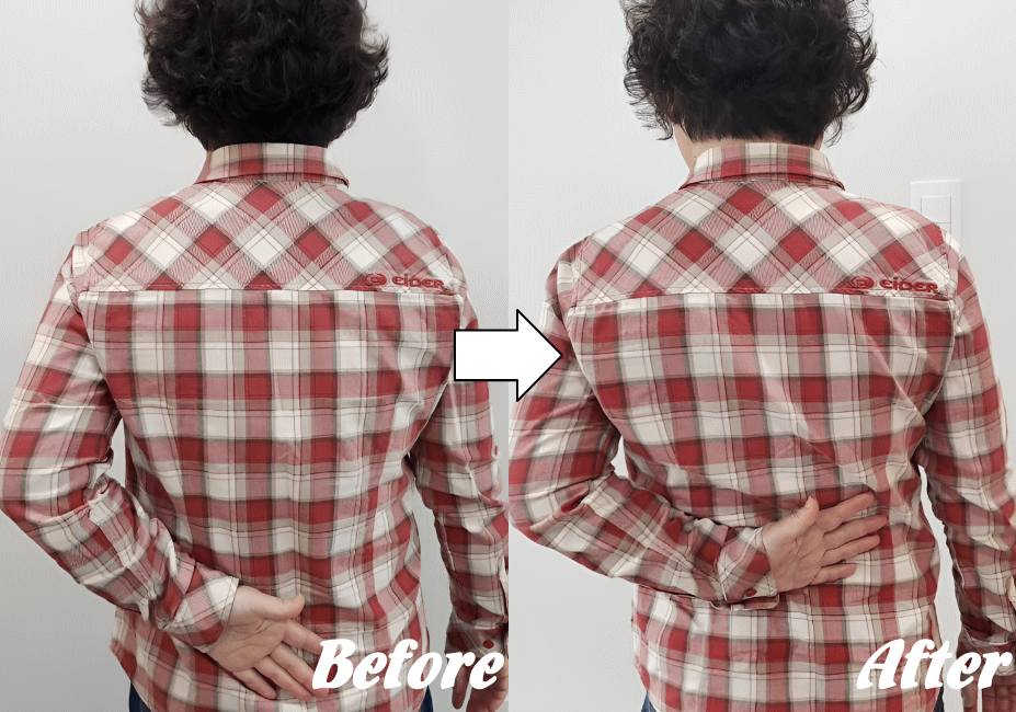 施術前と施術後83