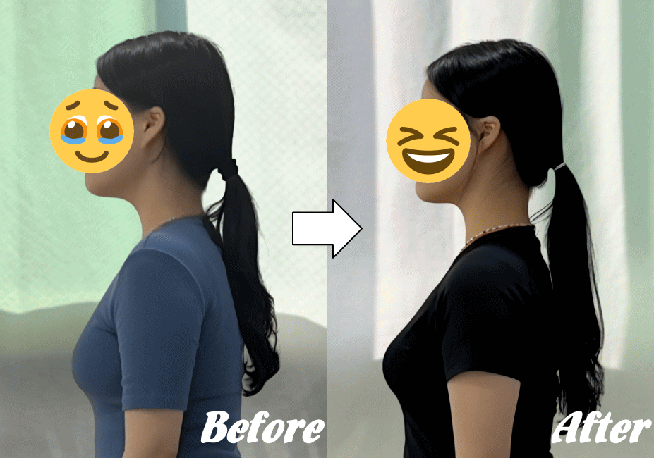 施術前と施術後84