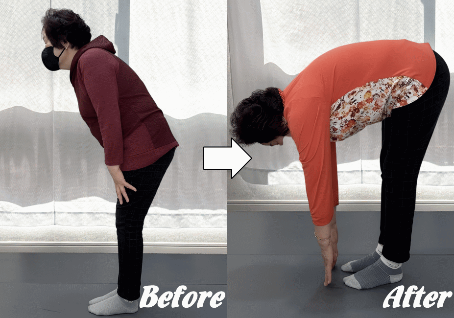 施術前と施術後01