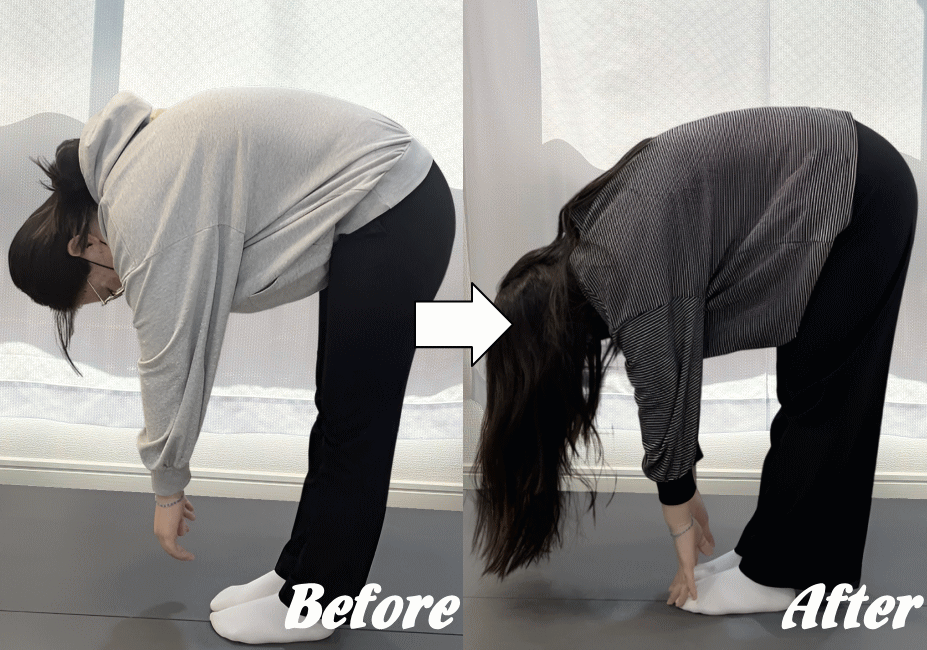 施術前と施術後02