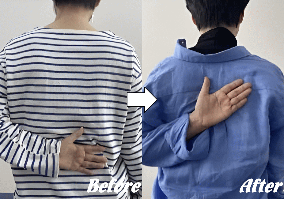 施術前と施術後85