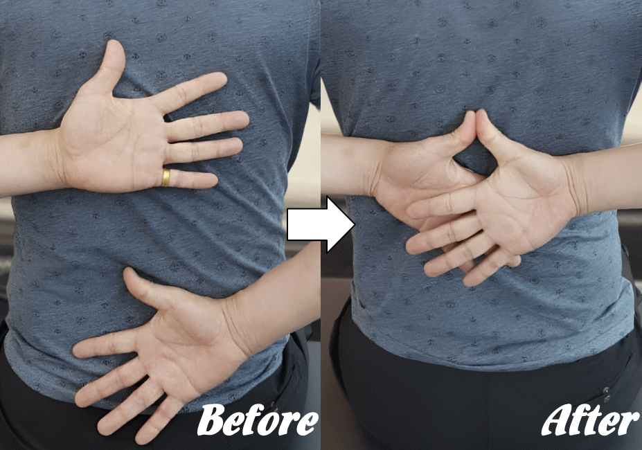 施術前と施術後86