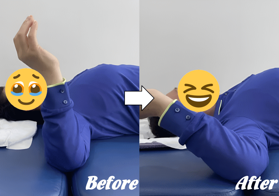 施術前と施術後87