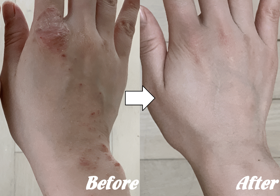 施術前と施術後J