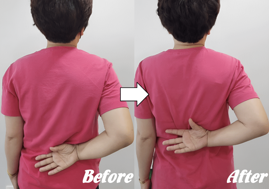 施術前と施術後89