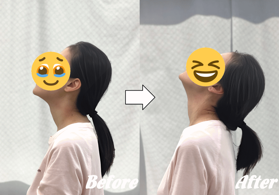 施術前と施術後90