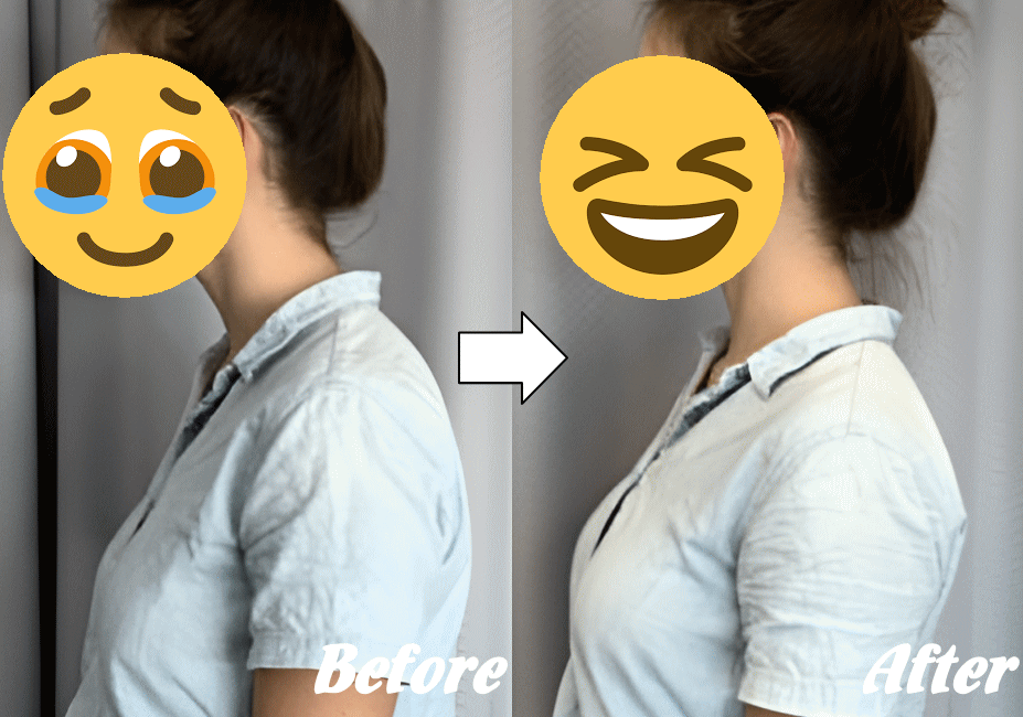 施術前と施術後95