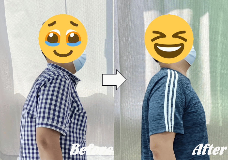 施術前と施術後96