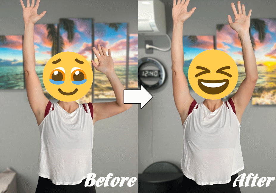 施術前と施術後03