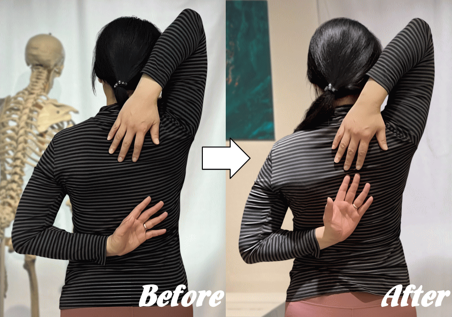 施術前と施術後04