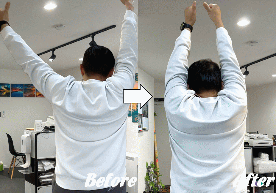 施術前と施術後05