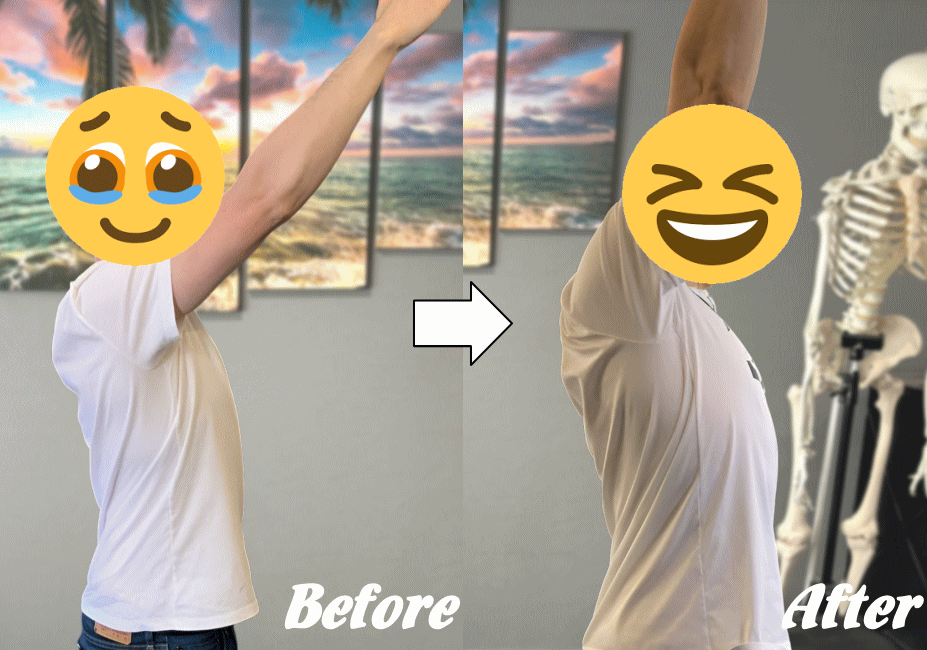 施術前と施術後06